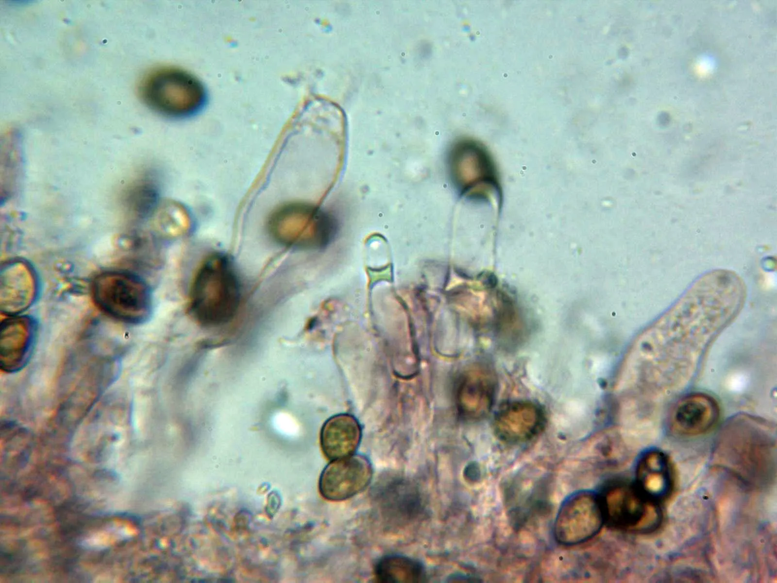 10 - Basidio tetrasporico